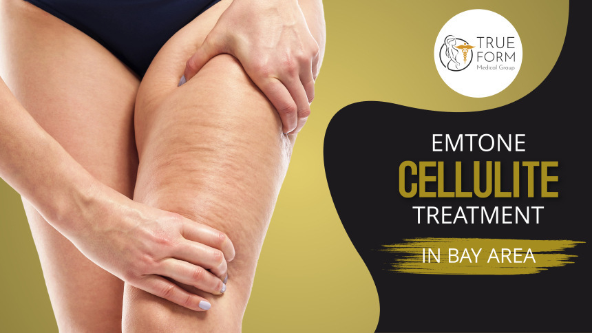 Emtone Cellulite Treatment in Bay Area